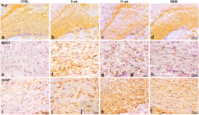 Astrocyte Derived Tissue Transglutaminase Affects Fibronectin Deposition But Not Aggregation During Cuprizone Induced Demyelination Scientific Reports