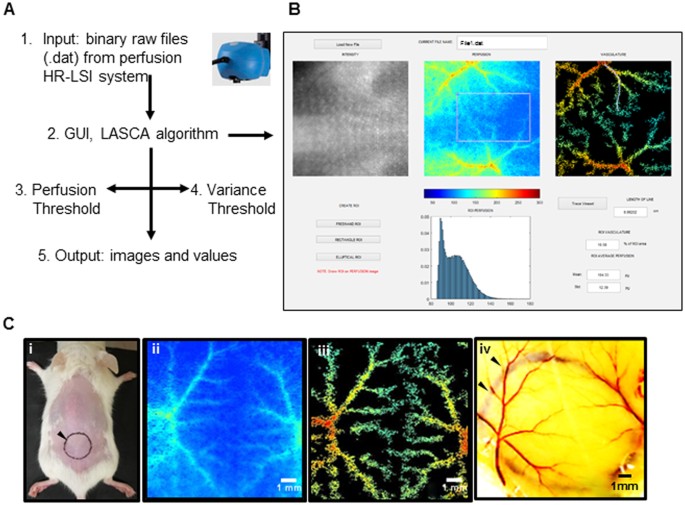 Retooling Laser Speckle Contrast Analysis Algorithm to Enhance Non-Invasive  High Resolution Laser Speckle Functional Imaging of Cutaneous  Microcirculation | Scientific Reports