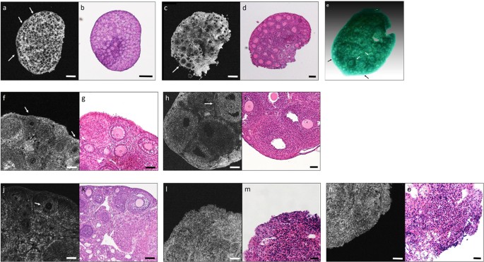 Accuracy And Safety Verification Of Ovarian Reserve Assessment Technique For Ovarian Tissue Transplantation Using Optical Coherence Tomography In Mice Ovary Scientific Reports Accuracy And Safety Verification Of Ovarian Reserve Assessment Technique For Ovarian Tissue Transplantation Using Optical Coherence Tomography In Mice Ovary Scientific Reports