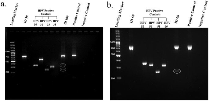 hpv high risk type 16 pcr