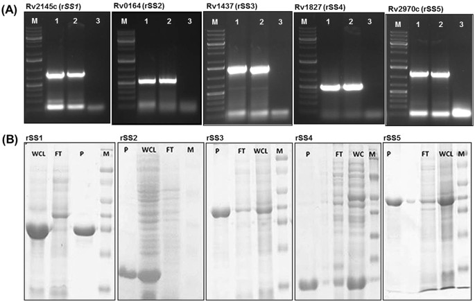 Evaluation Of 5 Novel Protein Biomarkers For The Rapid Diagnosis Of Pulmonary And Extra Pulmonary Tuberculosis Preliminary Results Scientific Reports Evaluation Of 5 Novel Protein Biomarkers For The Rapid Diagnosis Of Pulmonary And Extra Pulmonary Tuberculosis Preliminary Results Scientific Reports