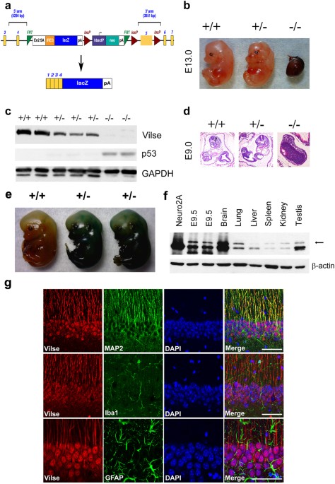 Important roles of vilse in dendritic architecture and synaptic plasticity