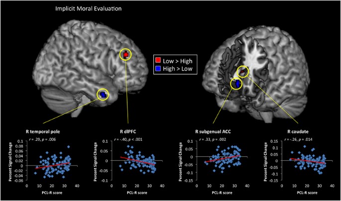 Neural networks underlying implicit and explicit moral evaluations 