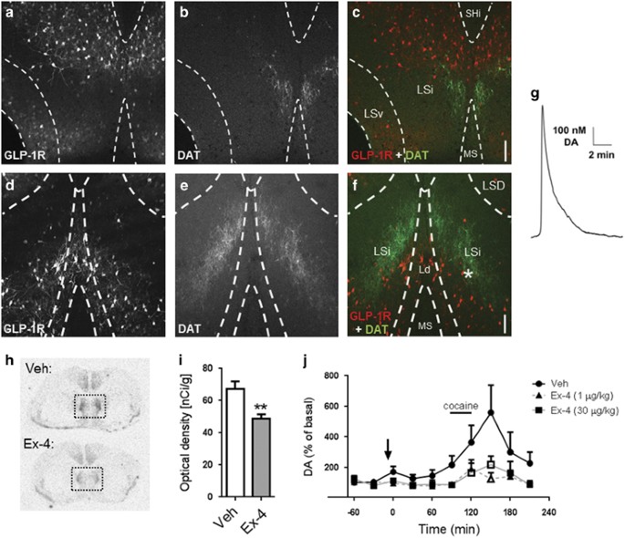 glp 1 dopamine Glucagon-like peptide 1 receptor activation regulates cocaine actions and  dopamine homeostasis in the lateral septum by decreasing arachidonic acid  levels
