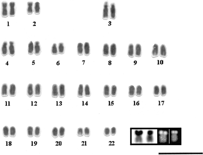 Localization Of Ribosomal Genes In Pleuronectiformes Using Ag Cma 3 Banding And In Situ Hybridization Heredity