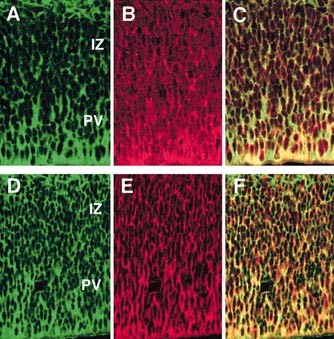 Expression Of Tubulin Beta Ii In Neural Stem Progenitor Cells And Radial Fibers During Human Fetal Brain Development Laboratory Investigation Expression Of Tubulin Beta Ii In Neural Stem Progenitor Cells And Radial Fibers During Human Fetal Brain Development Laboratory Investigation