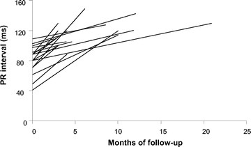 Electrocardiographic Response To Enzyme Replacement Therapy For Pompe Disease Genetics In Medicine