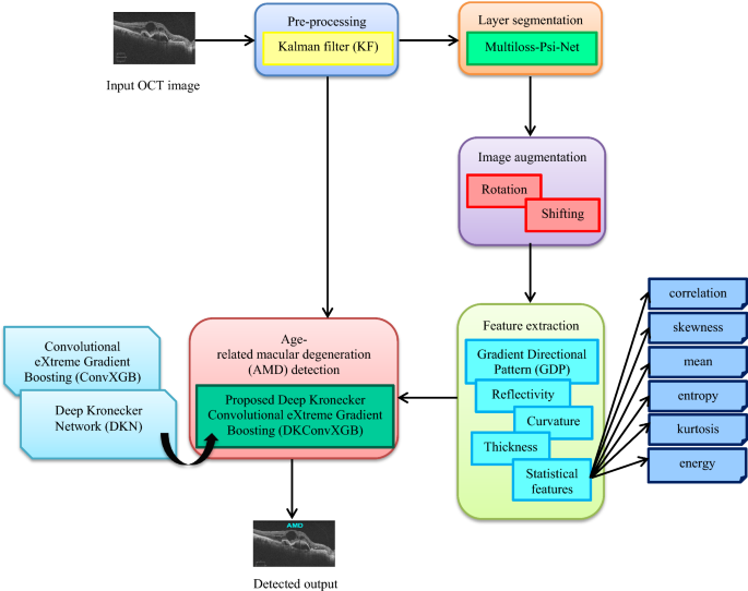 Deep Kronecker Convolutional eXtreme Gradient Boosting network-based age-related macular degeneration detection using OCT images - The European Physical Journal Plus