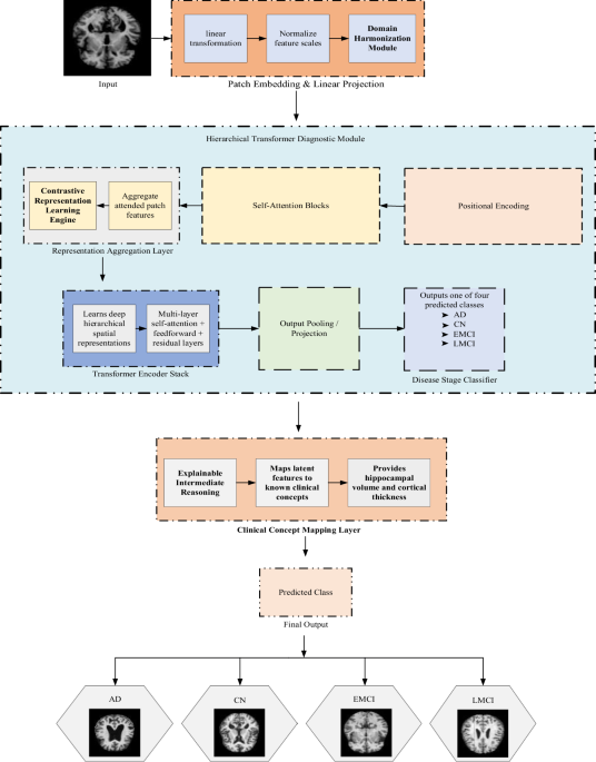 ETDST: an explainable transfer learning domain-adaptive self-supervised transformer framework for robust and interpretable Alzheimer’s disease diagnosis - The European Physical Journal Plus