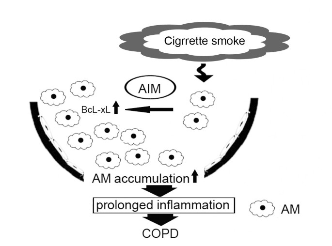 Apoptosis inhibitor of macrophage (AIM) expression in alveolar macrophages  in COPD | Respiratory Research | Full Text