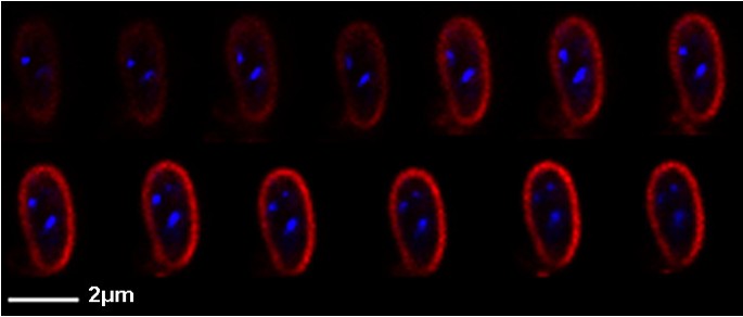 Home - Deinococcus geothermalis DSM 11300