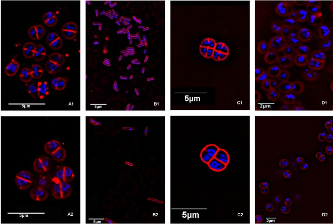 Extremophile organisms: Deinococcus radiodurans. Science blog 121