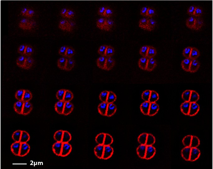 Ringlike Structure of the Deinococcus radiodurans Genome: A Key to