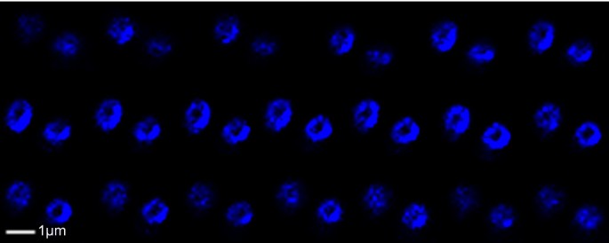 Ringlike Structure of the Deinococcus radiodurans Genome: A Key to