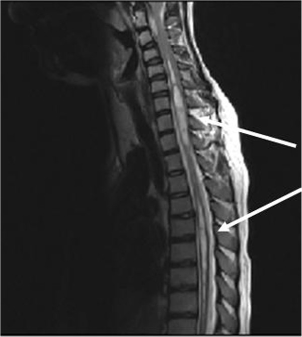 Novel cAMP binding protein-BP (CREBBP) mutation in a girl with Rubinstein- Taybi syndrome, GH deficiency, Arnold Chiari malformation and pituitary  hypoplasia – topic of research paper in Clinical medicine. Download  scholarly article PDF