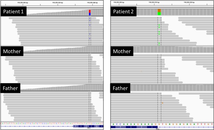 Expanding the phenotype associated to KMT2A variants: overlapping clinical  signs between Wiedemann–Steiner and Rubinstein–Taybi syndromes