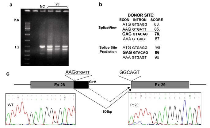 CREBBP and EP300 mutational spectrum and clinical presentations in a cohort  of Swedish patients with Rubinstein–Taybi syndrome - Wincent - 2016 -  Molecular Genetics & Genomic Medicine - Wiley Online Library