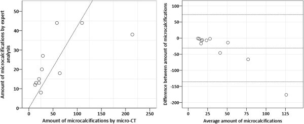 High-resolution 3D micro-CT imaging of breast microcalcifications