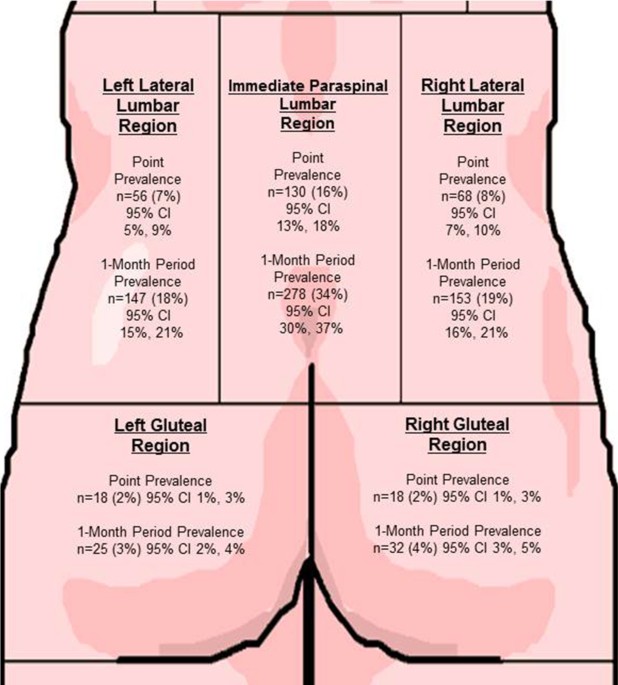 Prevalence of low back pain by anatomic location and intensity in an  occupational population | BMC Musculoskeletal Disorders | Full Text