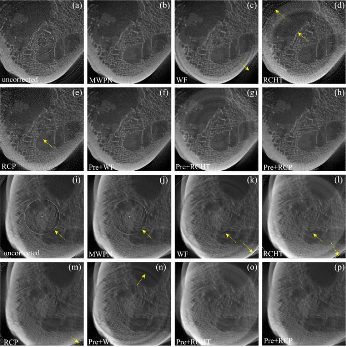Comparison of ring artifact removal methods using flat panel detector based  CT images | BioMedical Engineering OnLine | Full Text