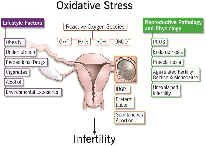 The effects of oxidative stress on female reproduction: a review |  Reproductive Biology and Endocrinology