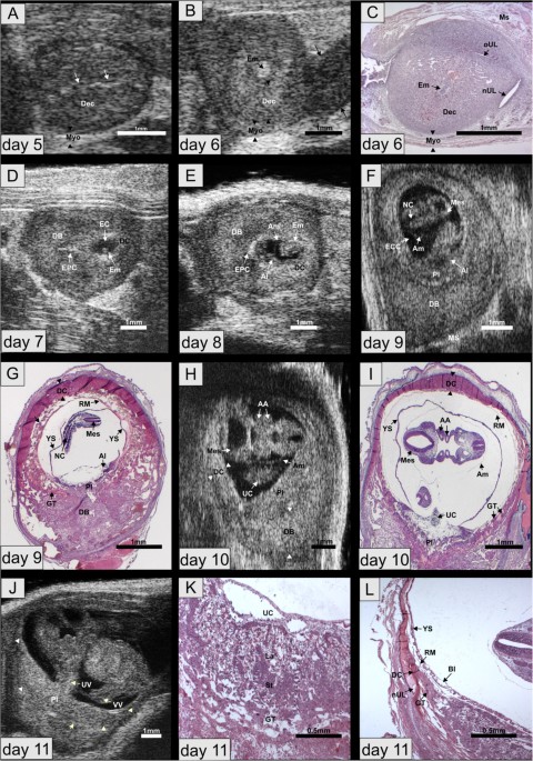 Resorption cavity rings and localized vascular changes within the