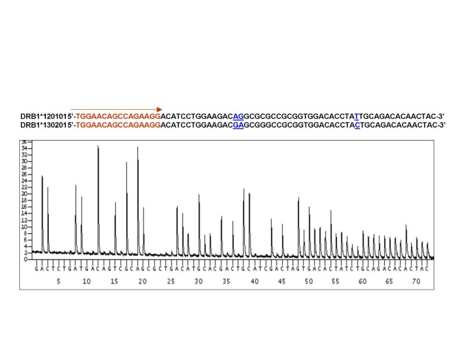 Pyrosequencing™ : A one-step method for high resolution HLA typing |  Journal of Translational Medicine | Full Text