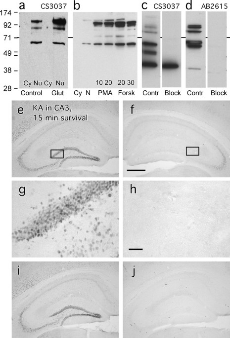 Cautionary notes on the use of NF-κB p65 and p50 antibodies for CNS studies, Journal of Neuroinflammation