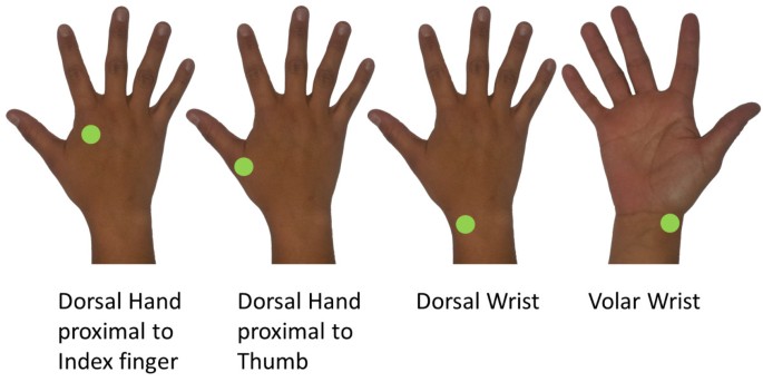 Remote vibrotactile noise improves light touch sensation in stroke  survivors' fingertips via stochastic resonance | Journal of  NeuroEngineering and Rehabilitation | Springer Nature Link