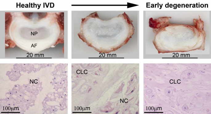 bpc-157 intervertebral disc degeneration study Potential regenerative treatment strategies for intervertebral disc degeneration in dogs | BMC Veterinary Research bpc-157 intervertebral disc degeneration study Potential regenerative treatment strategies for intervertebral disc degeneration in dogs | BMC Veterinary Research