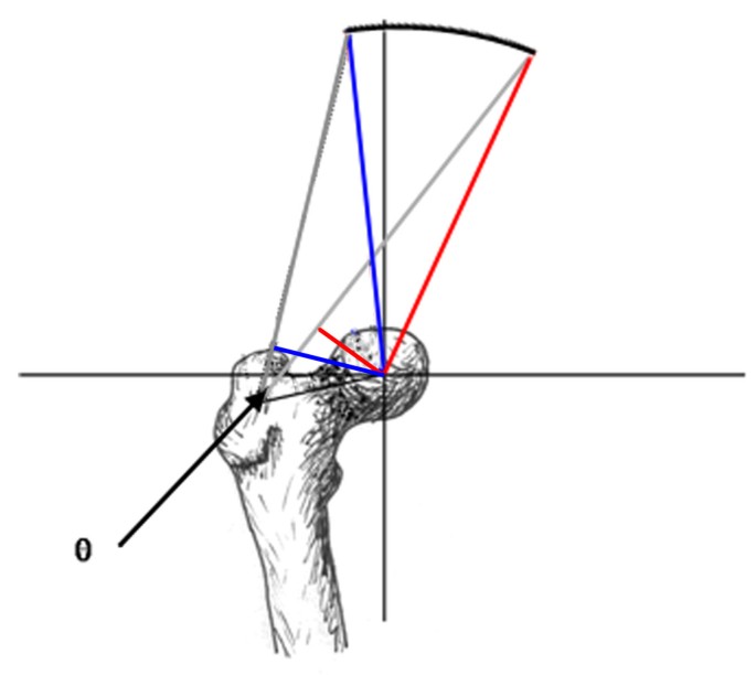 The simulation of isometric contraction of the isolated hip adductor
