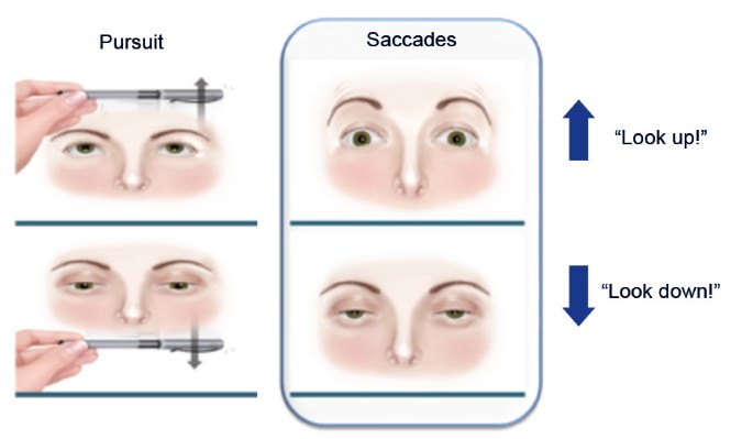 Diagnostic and predictive methods for a Niemann-Pick disease type