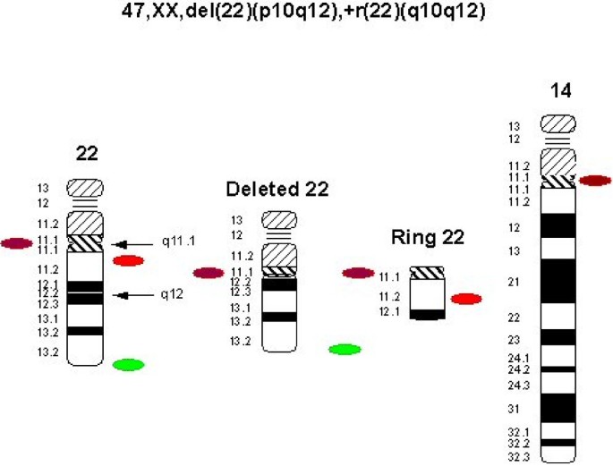 Patients I-V, VII-IX and XI-XIV, who present ring chromosomes 3, 4, 10,...  | Download Scientific Diagram