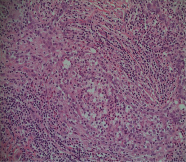 A photograph of the patient's left breast. Clinical appearance of the