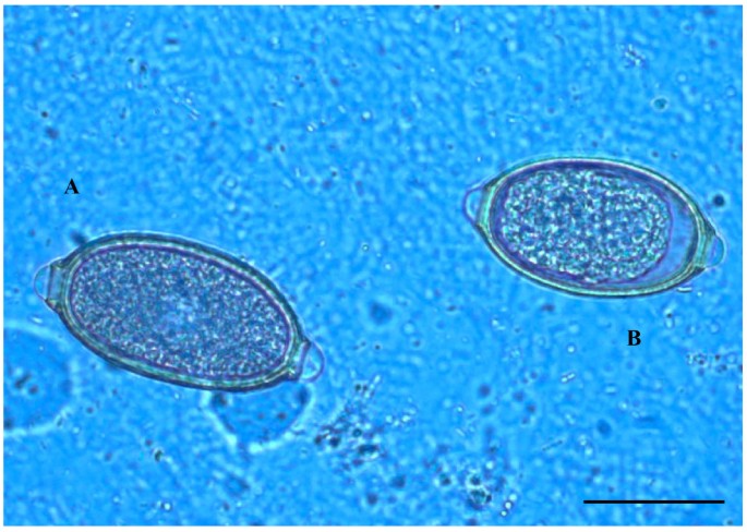 Mixed trichuroid infestation in a dog from Italy | Parasites & Vectors |  Full Text