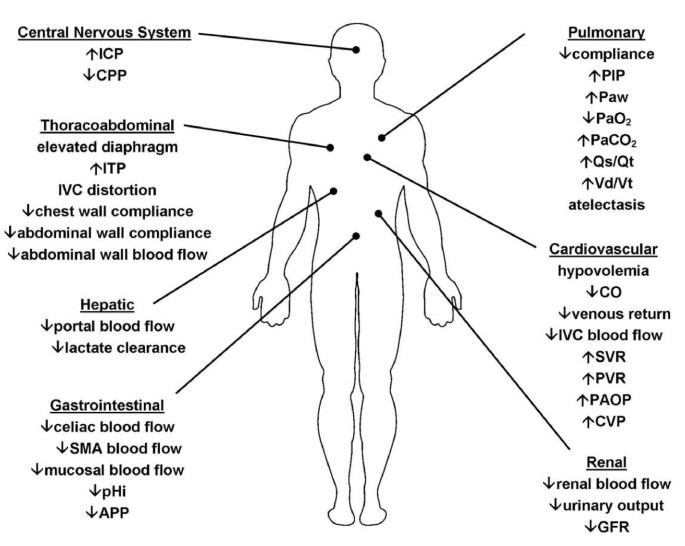 Abdominal Compartment Syndrome: pathophysiology and definitions
