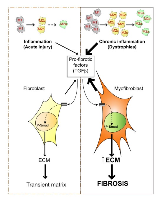Inflammation and macrophage polarization in skeletal muscle injury and