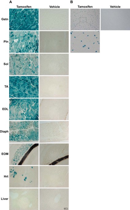 Temporally Regulated and Tissue-Specific Gene Manipulations in the