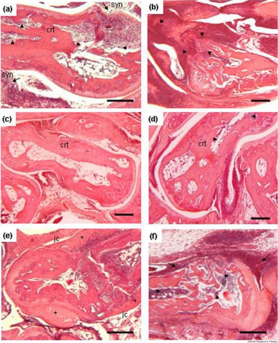 Effect of phospholipase A2inhibitory peptide on inflammatory arthritis in a  TNF transgenic mouse model: a time-course ultrastructural study, Arthritis  Research & Therapy