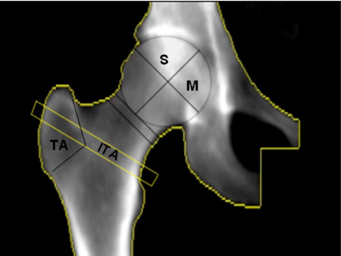 DEXA Bone Density  Arthritis & Sports