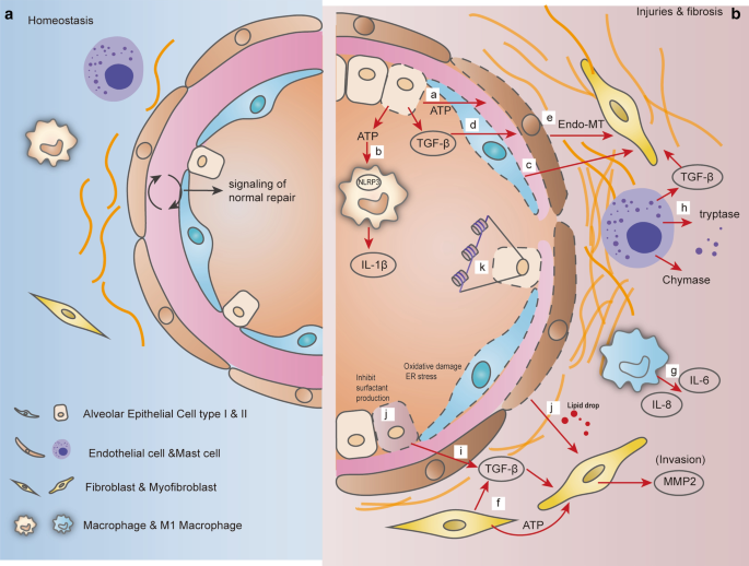 Complex urban atmosphere alters alveolar stem cells niche properties and  drives lung fibrosis