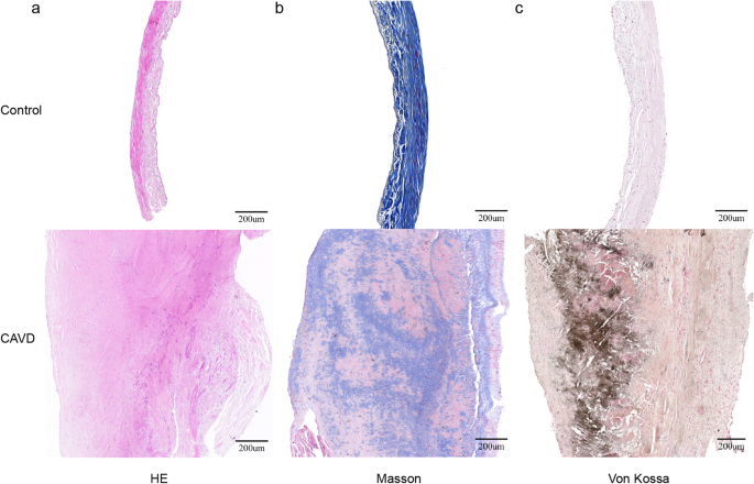 atrioventricular valve histology