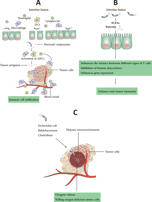 does glutathione iv reduce eeffectiveless of radiation therepy Microbiome in radiotherapy: an emerging approach to enhance treatment  efficacy and reduce tissue injury | Molecular Medicine