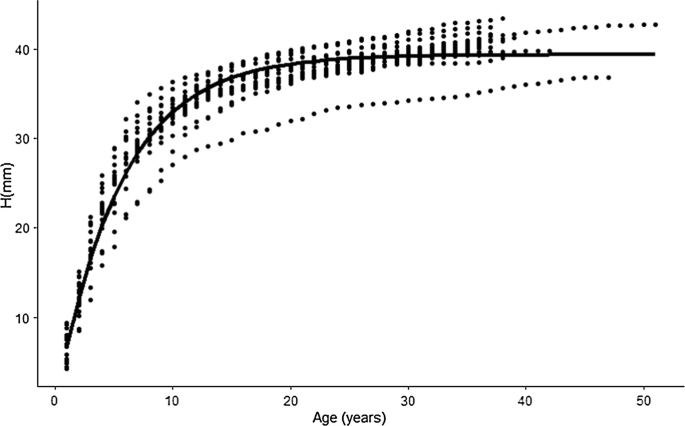 The von Bertalanffy growth parameters values of C. regium reported from