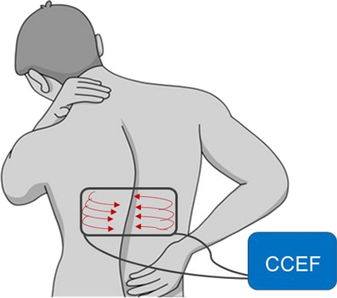 Capacitive biophysical stimulation improves the healing of vertebral fragility fractures: a prospective multicentre randomized controlled trial