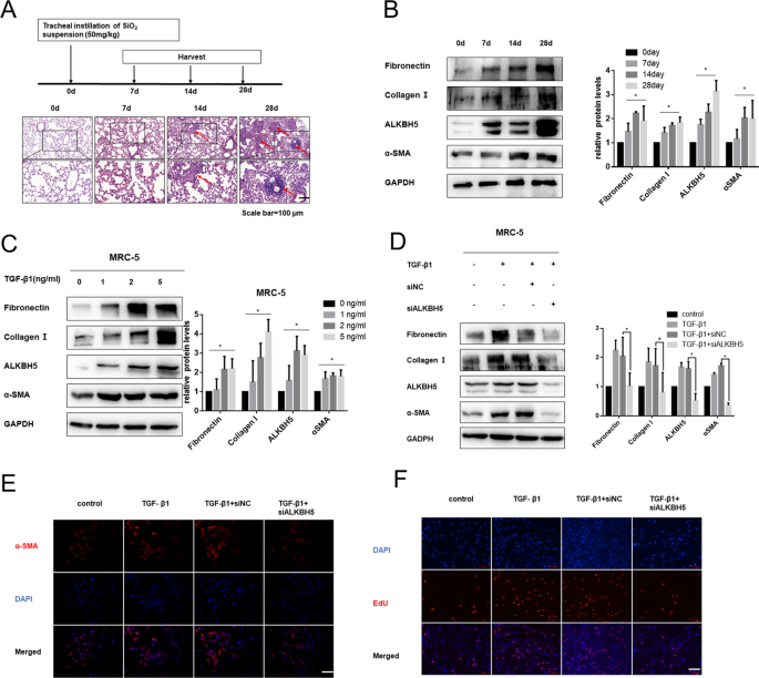 ipamorelin effects fibroblast Dual Role of Fibroblasts Educated by Tumour in Cancer Behavior and Therapeutic Perspectives Preclinical Development of PNT6555, a