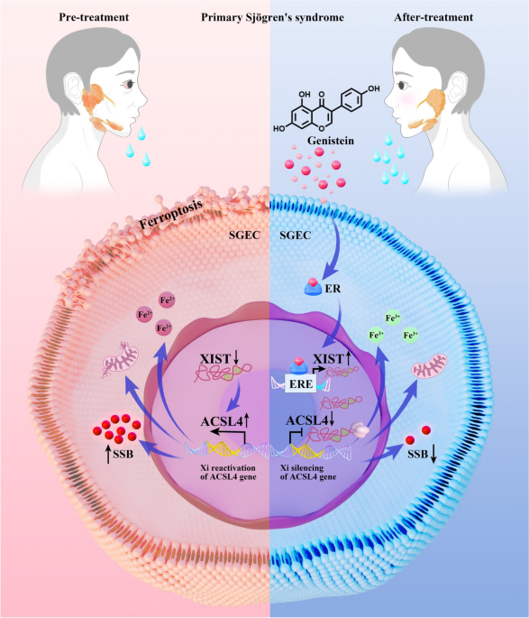 glutathione sjogren's syndrome protects against hepatic injury in a murine model of primary Sjgren's Lipid Metabolism: An Emerging Player