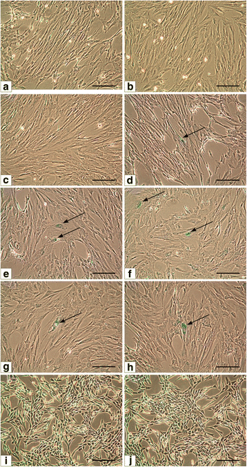 Isolation, expansion and characterization of porcine urinary bladder smooth  muscle cells for tissue engineering, Biological Procedures Online
