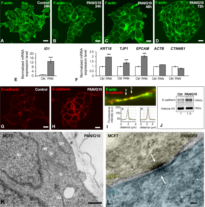 Time-lapse imaging of particle invasion and deposition in porous