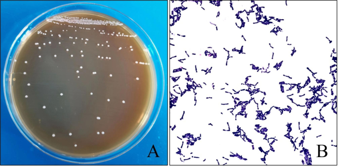 glutathione bifidobacterium Antioxidant effects of longum T37a in mice weight loss and aging model induced by D-galactose | BMC Microbiology DSIP Peptide Benefits For